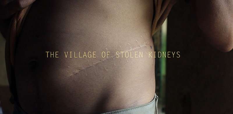 the-village-of-stolen-kidneys